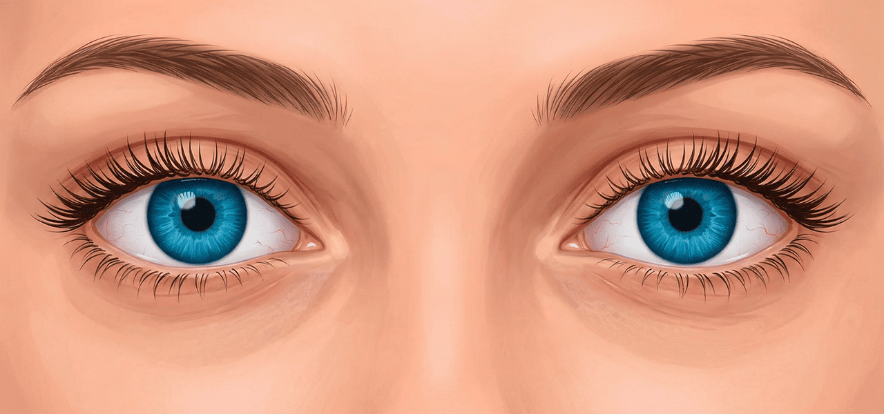 Птоз верхнего века