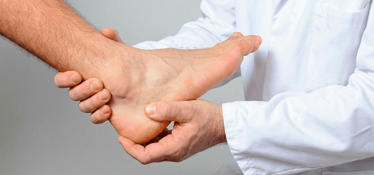 Полинейропатия