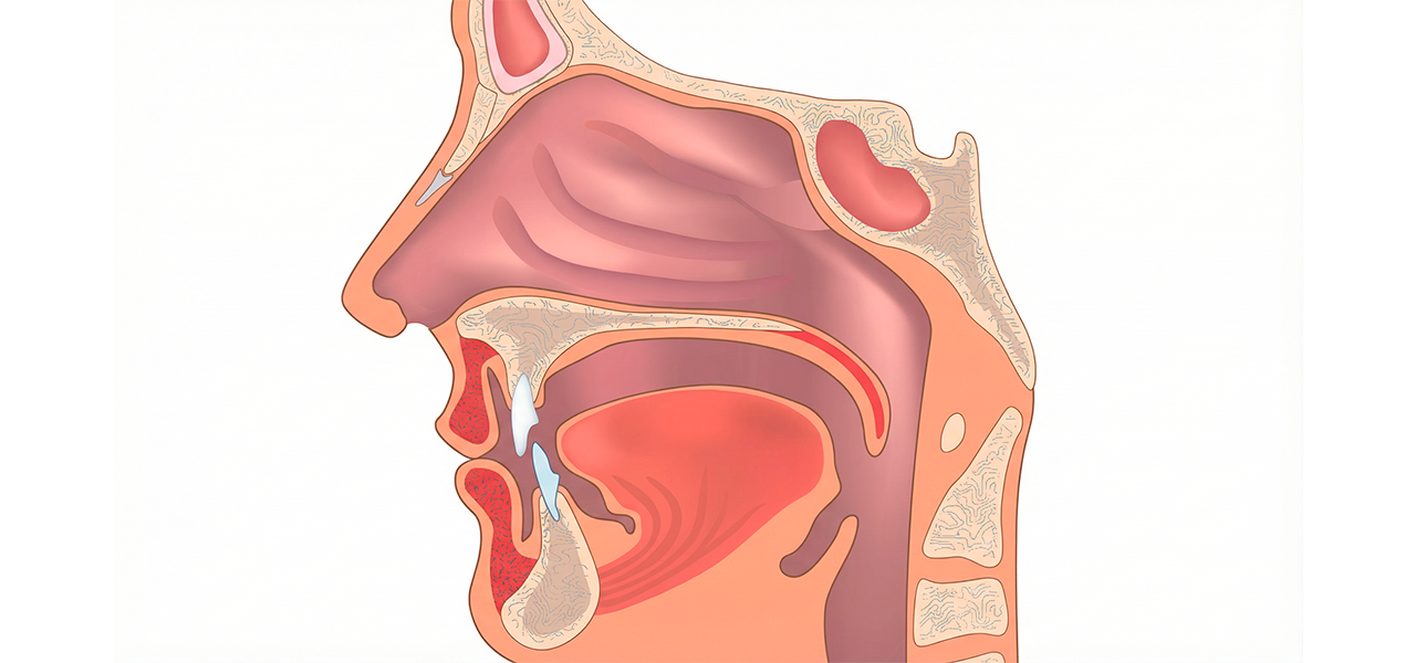 Болезни носовой полости