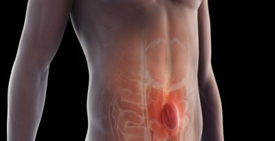 У меня грыжа? Что делать? У меня грыжа? Что делать?