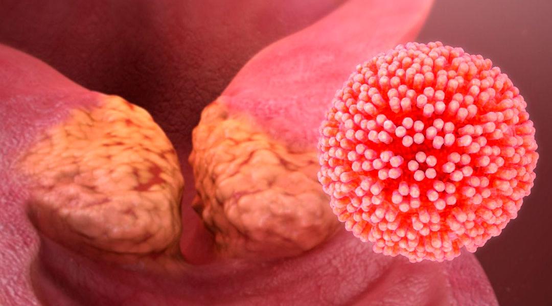 Защититесь от рака шейки матки