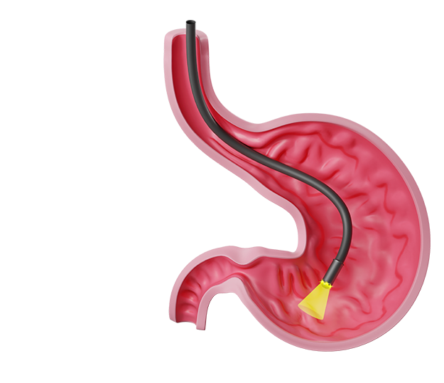 Гастроскопия под ключ в Раменском — 9 000 ₽