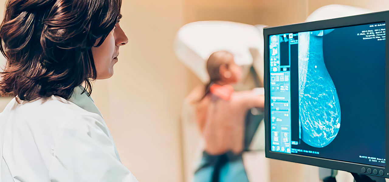 Маммография и УЗИ молочных желез: что выбрать? 
