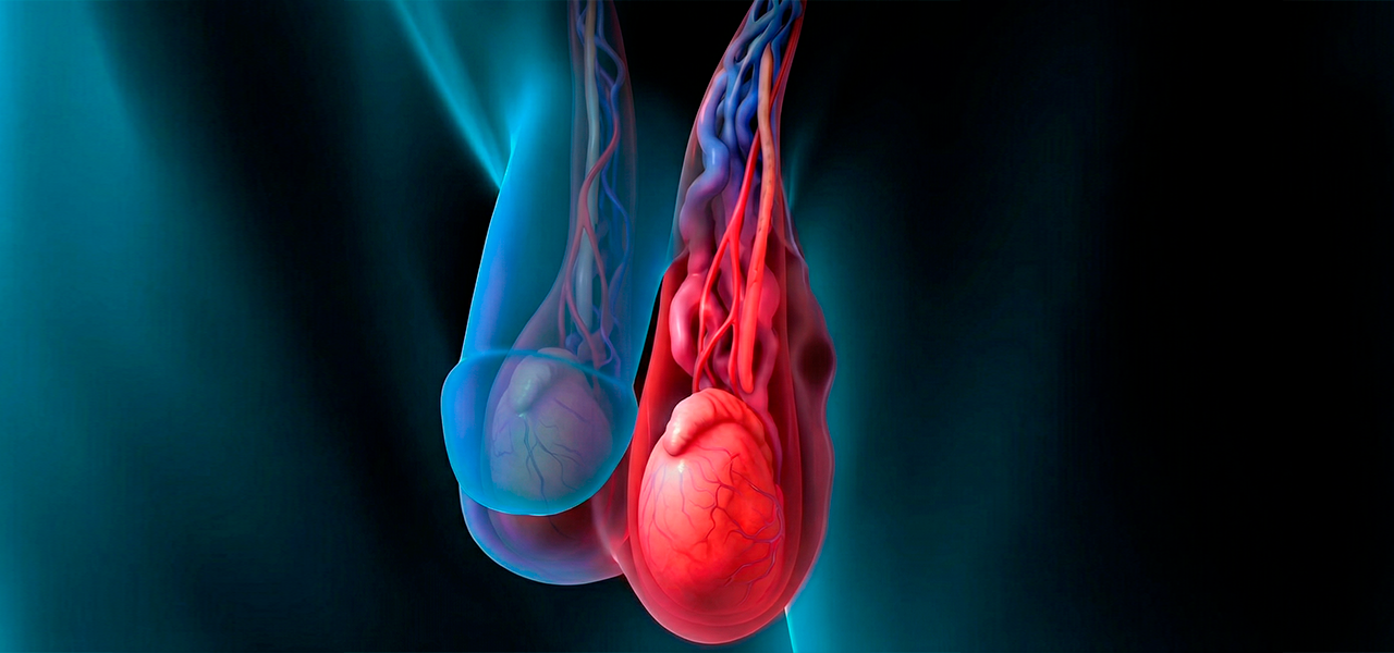 Варикоз яичек