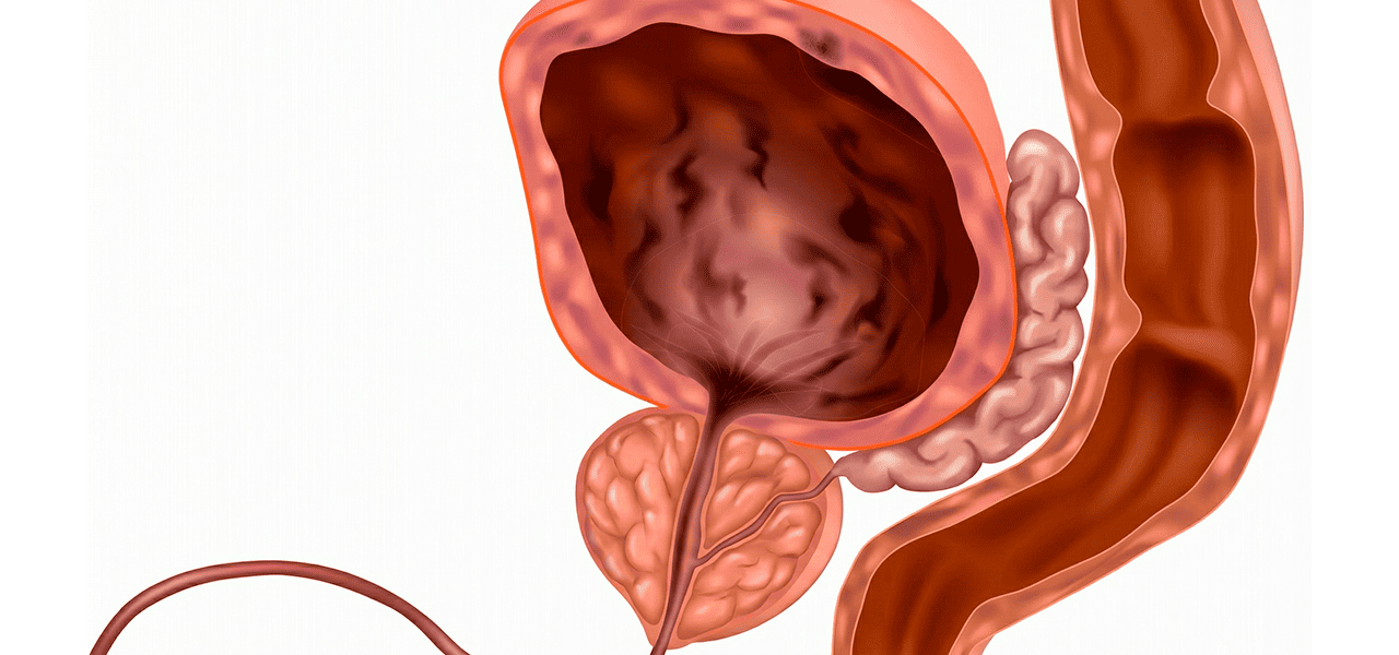 Воспаление уретры