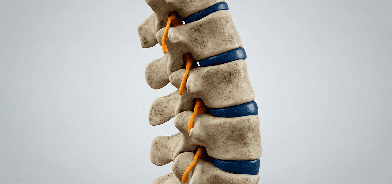 Остеохондроз