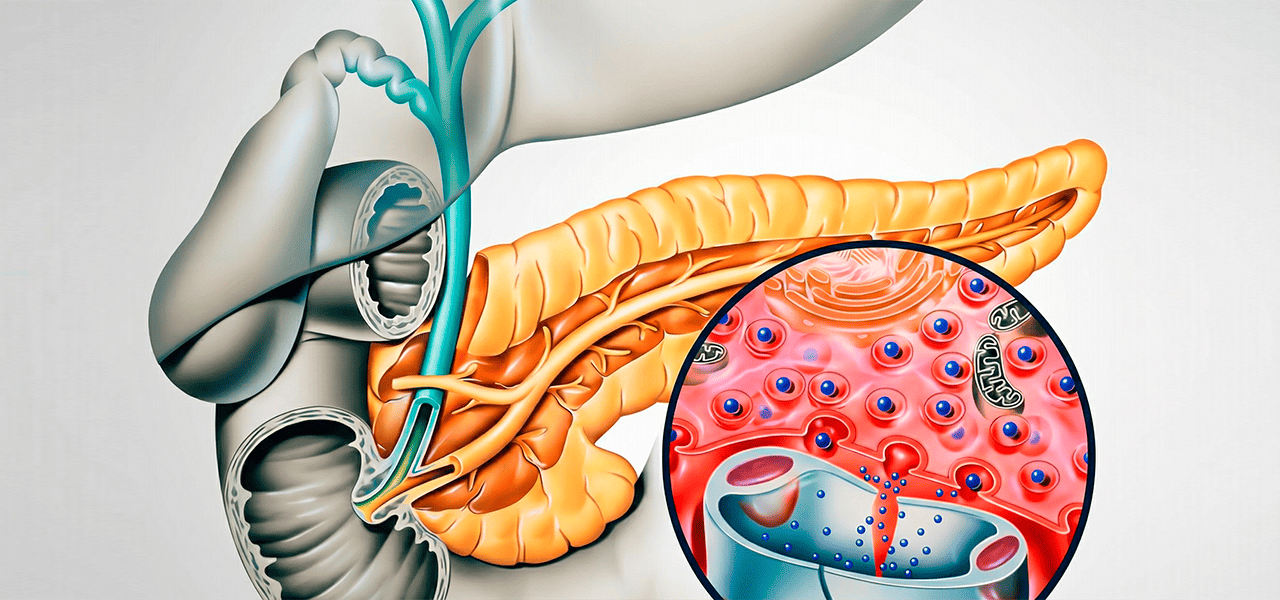 Воспаление поджелудочной железы