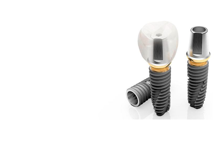 Имплантация зубов «под ключ» OSSTEM