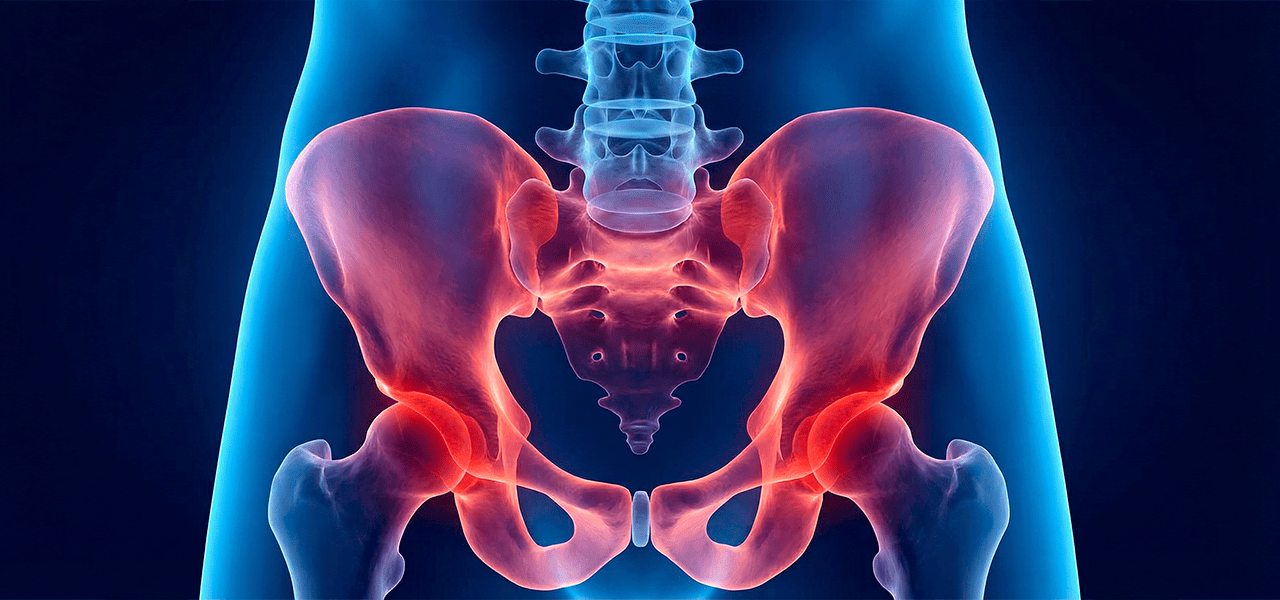 Опущение органов малого таза