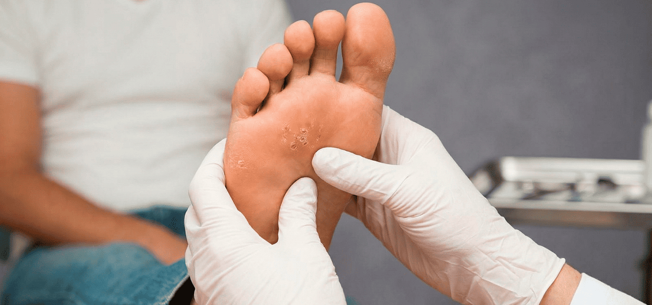 Трофическая язва