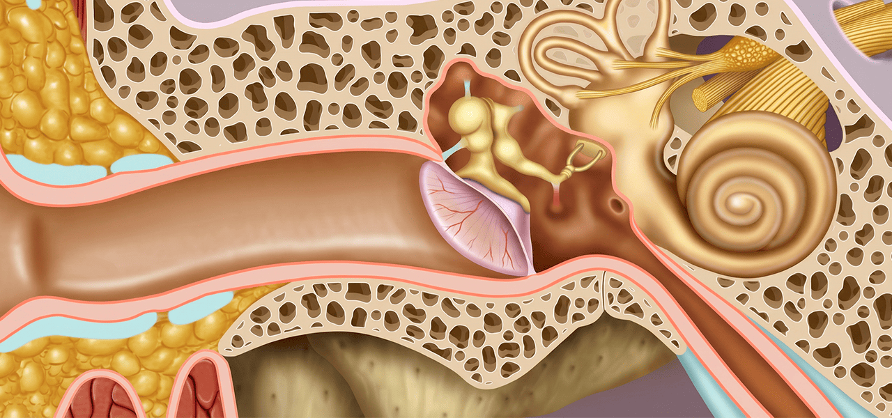 Адгезивный средний отит