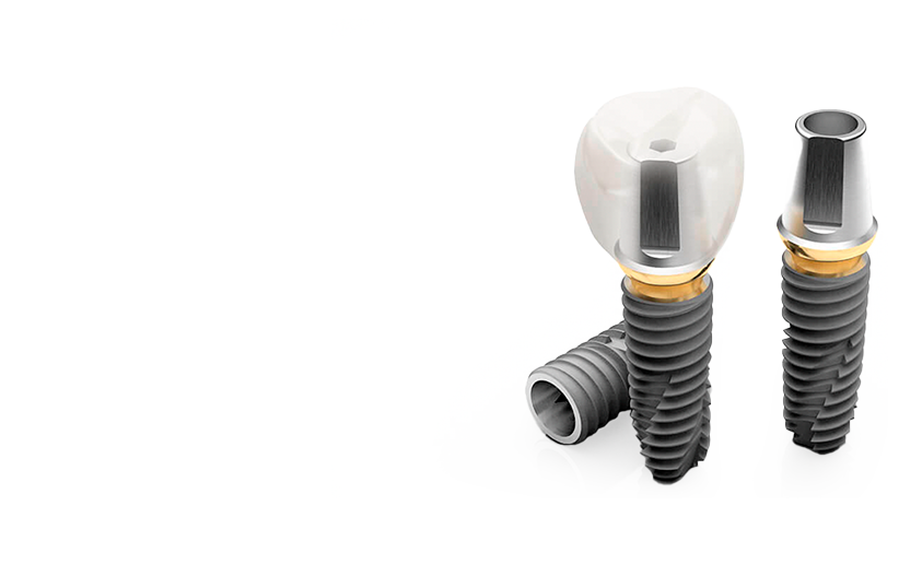 Имплантация зубов «под ключ» OSSTEM