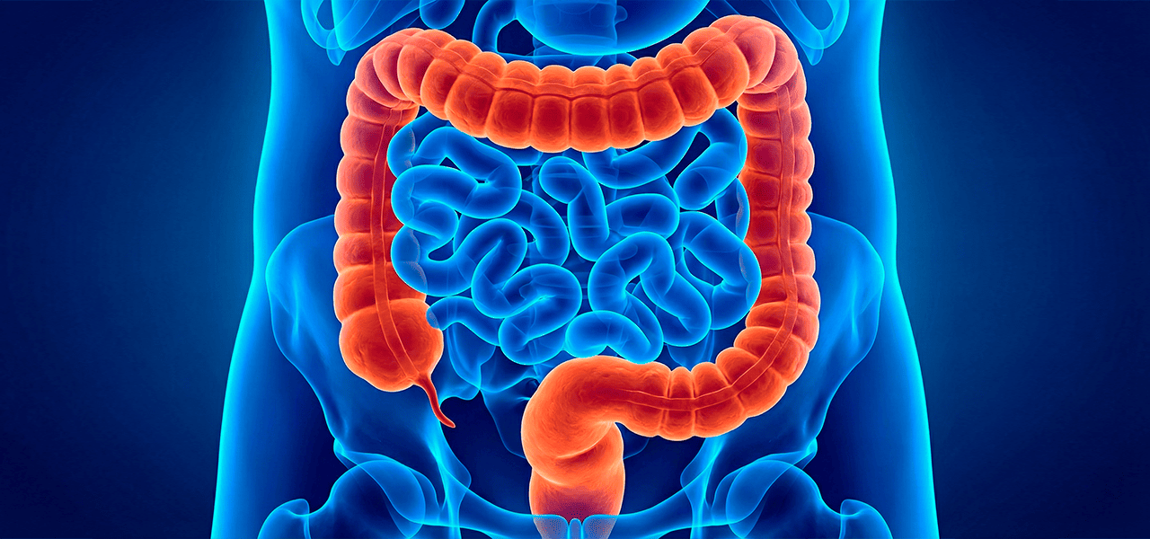 Свищ прямой кишки