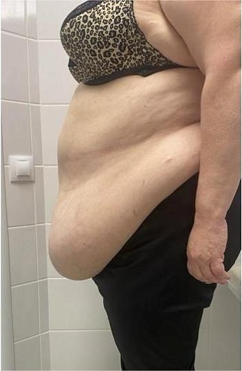 До операции 