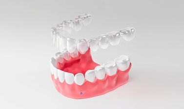 Невидимая ортодонтия: всё об элайнерах и их преимуществах