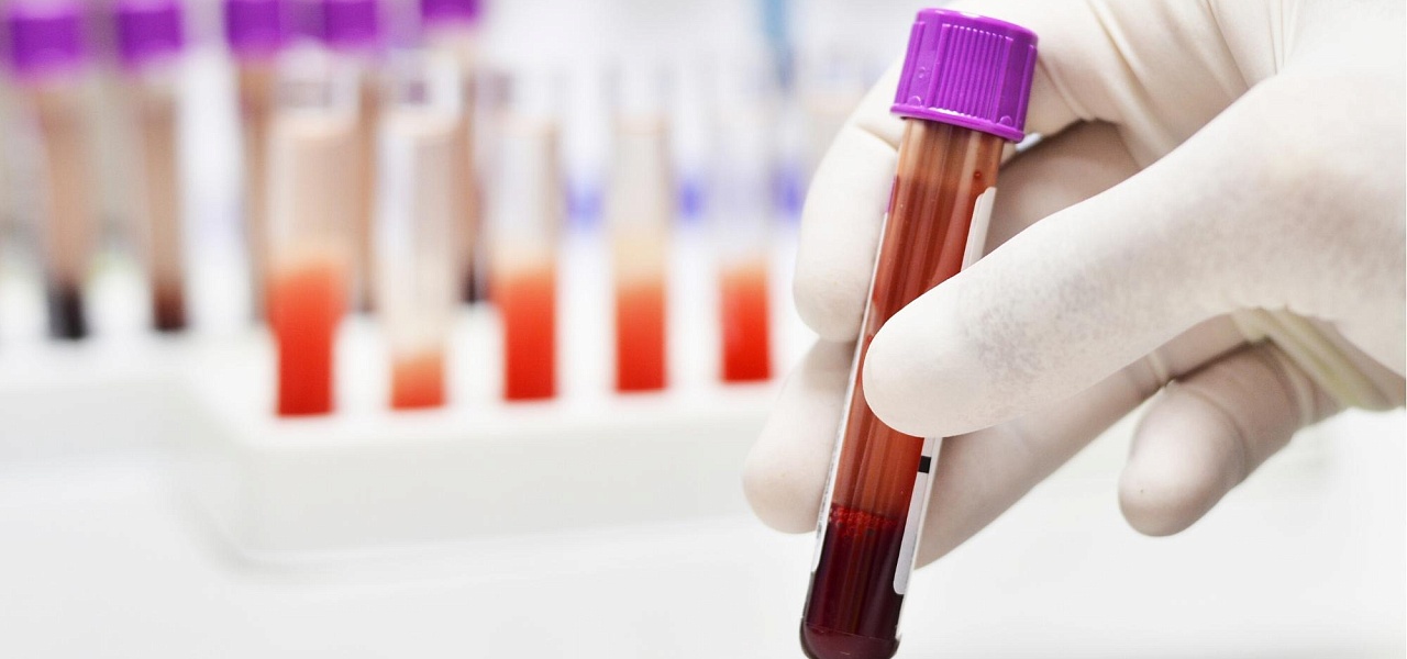 График работы процедурного кабинета 100med Лыткарино График работы процедурного кабинета 100med Лыткарино