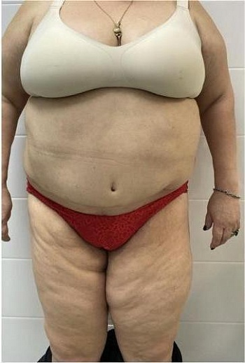 После операции 