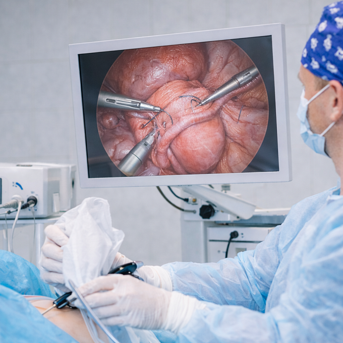 Операция Боари (цистоуретеропластика)