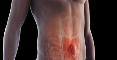 У меня грыжа? Что делать?