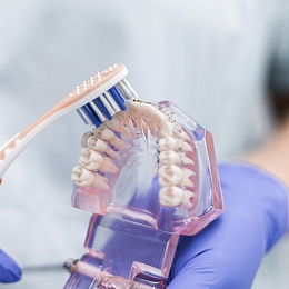 Брекеты для выравнивания зубов: виды, стоимость и уход