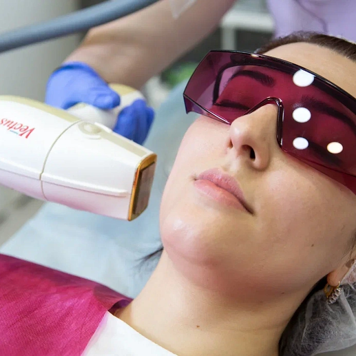 Лазерная эпиляция бровей