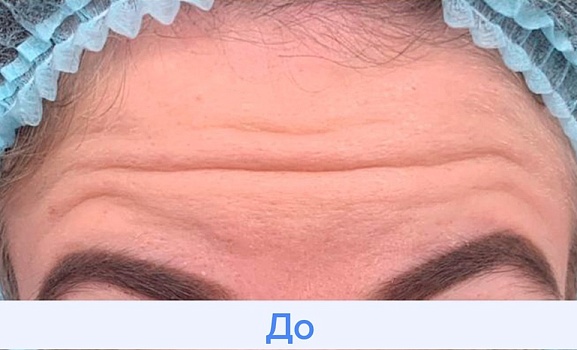 До процедуры 
