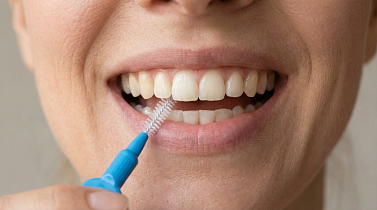 Как правильно ухаживать за зубными имплантами