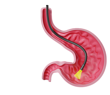 Гастроскопия под ключ в Раменском — 9 000 ₽