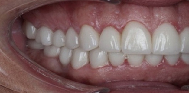 После 