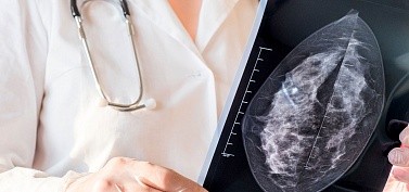 Расшифровка результатов маммографии