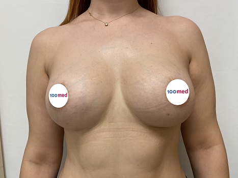 После операции 