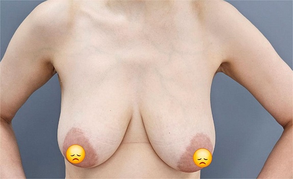 До операции 