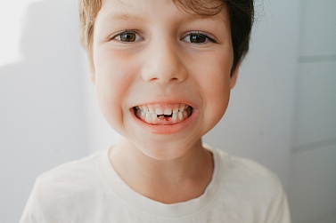 Когда и как выпадают молочные зубы у детей: график, нормы и советы родителям