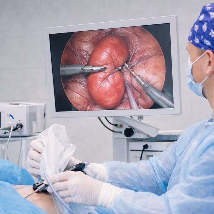 Нефропексия