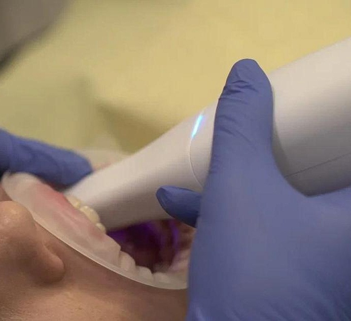 Коронки на зубы