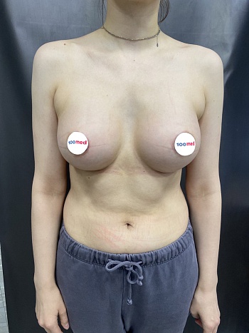 После операции 