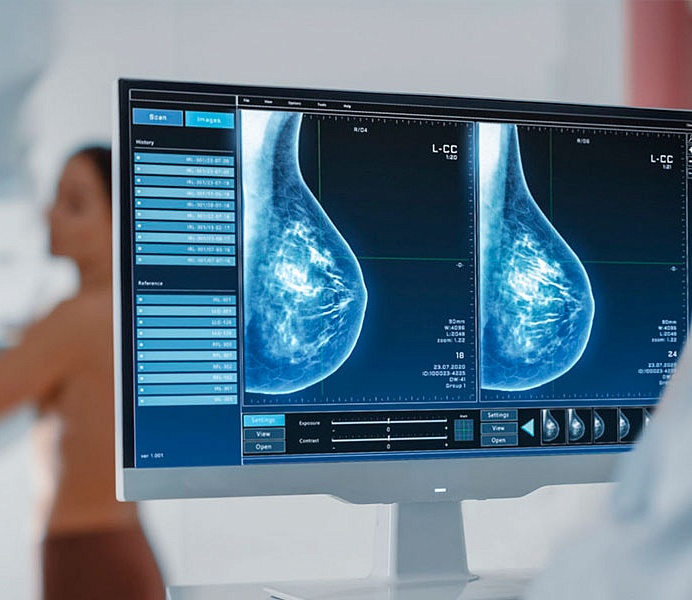 Маммография