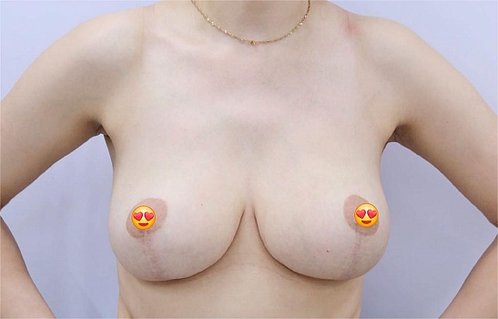 После операции 