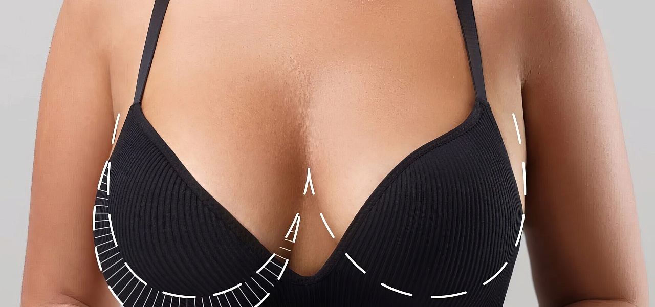 Обвисшая грудь