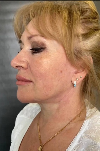 После операции 