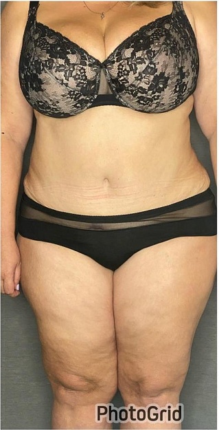 После операции 