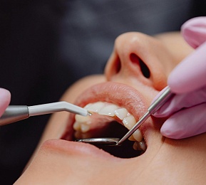 Поставить пломбу на зуб: как выбрать материал и сколько это стоит?