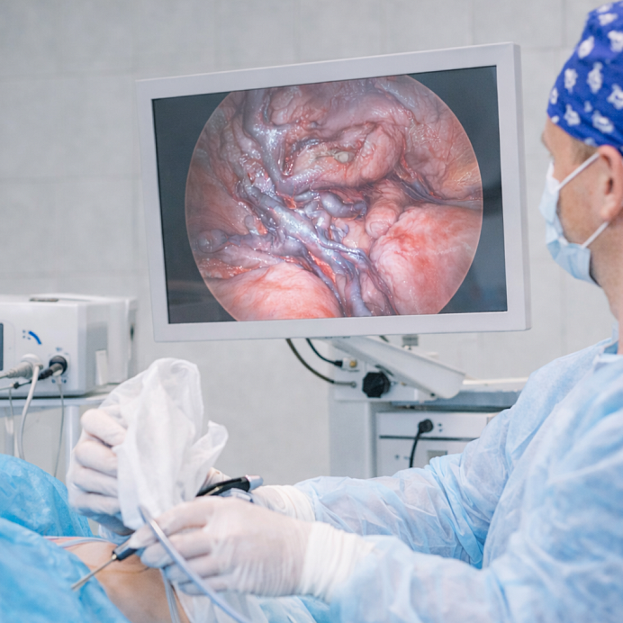 Лапароскопическое лечение варикоцеле