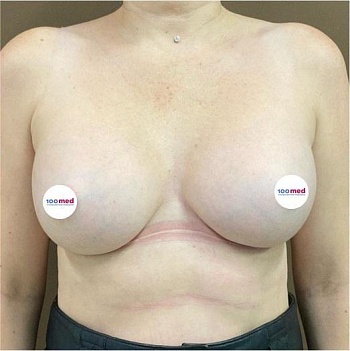 После операции 