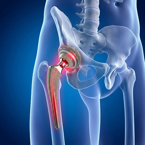 Показания и противопоказания