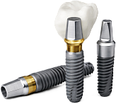 Все-на-6 на Osstem