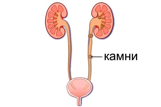 Причины