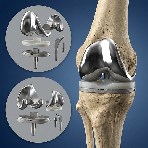 Показания и противопоказания