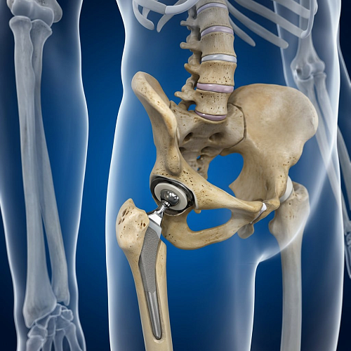 Как проходит операция