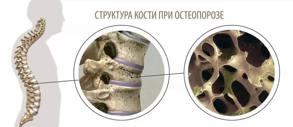 Симптомы
